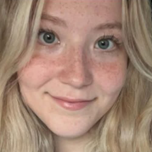 Hannah, Smokey Point Veterinary Assistant